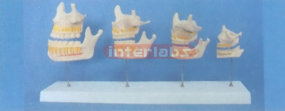 DIFFERENTIAL DENTITION DEVELOPMENT (4 PCS)